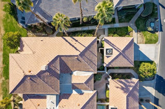 Overhead