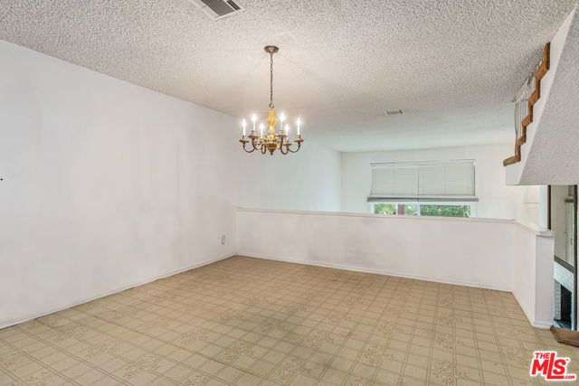 before photo